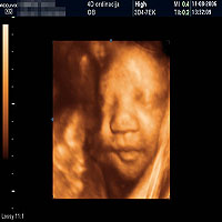 Ultrazvucni pregled beograd